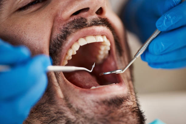 Best Tooth Infection Emergency Dentist  in Munfordville, KY