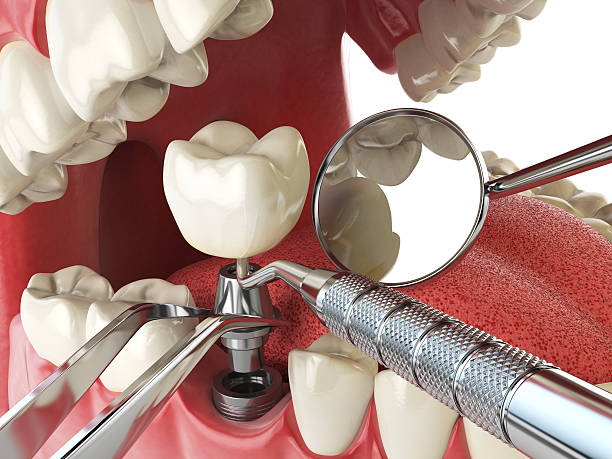 Best Tooth Infection Emergency Dentist  in Munfordville, KY